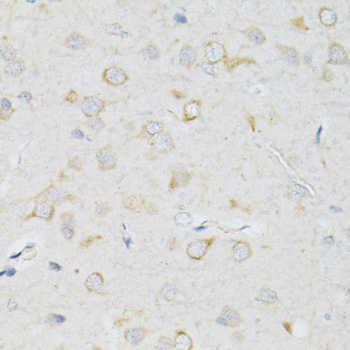 Anti-SLC2A13 Polyclonal Antibody (CAB9993)