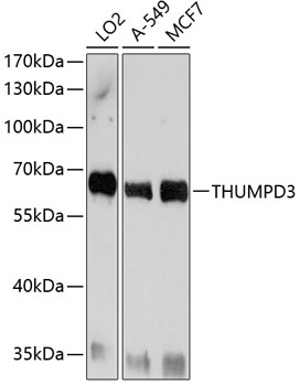 Anti-THUMPD3 Antibody (CAB10407)