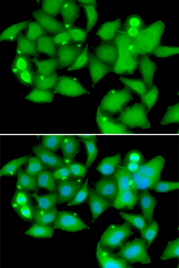 Anti-UBASH3B Antibody (CAB7141)