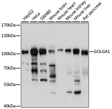 Anti-GOLGA1 Antibody (CAB14688)