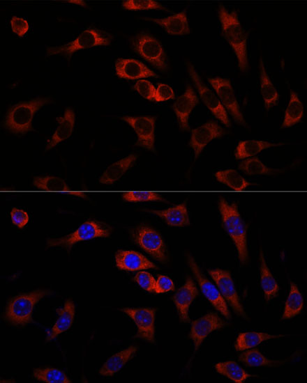 Anti-WNT10B Antibody (CAB16717)