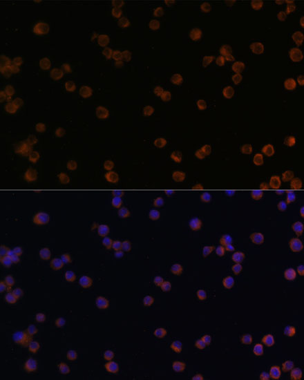 Anti-YKL-40 / CHI3L1 Antibody (CAB1723)