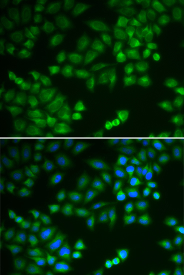 Anti-RPL5 Antibody (CAB1977)