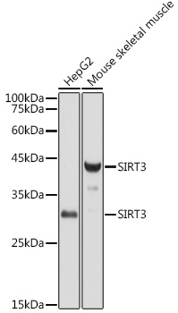 Anti-SIRT3 Antibody [KO Validated] (CAB5718)