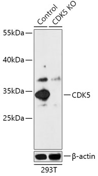 Anti-CDK5 Antibody [KO Validated] (CAB18080)