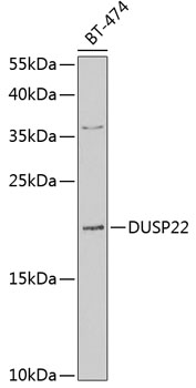 Anti-DUSP22 Antibody (CAB7281)