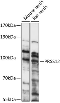 Anti-PRSS12 Antibody (CAB14319)