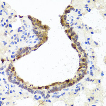 Anti-TOPBP1 Antibody (CAB12574)