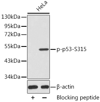 Anti-Phospho-TP53-S315 Antibody (CABP0462)