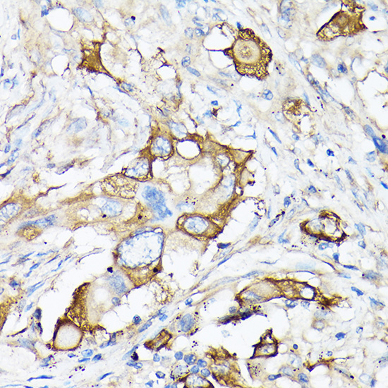 Anti-MMP7 Antibody (CAB0695)