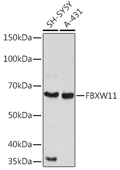 Anti-FBXW11 Antibody (CAB20010)