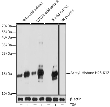 Anti-Acetyl-Histone H2B-K12 Antibody (CAB15619)