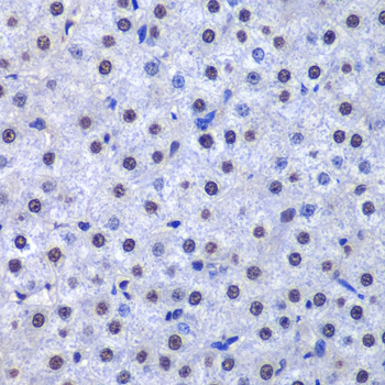 Anti-GSTP1 Antibody (CAB5691)