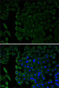 Anti-MSLN Antibody (CAB6183)