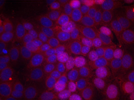 Anti-Phospho-Estrogen receptor-S106 Antibody (CABP0347)