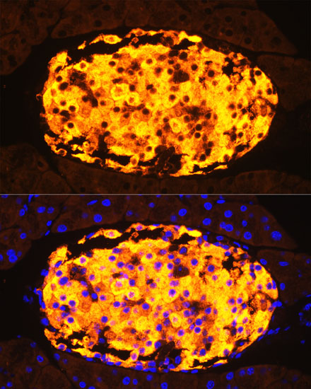 Anti-IAPP Antibody (CAB2816)