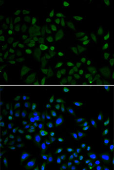 Anti-CBX8 Antibody (CAB6222)