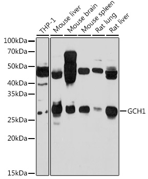 Anti-GCH1 Antibody (CAB10616)