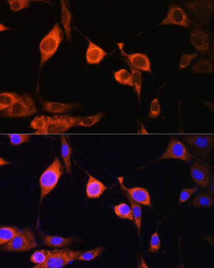 Anti-ATP5D Polyclonal Antibody (CAB9929)