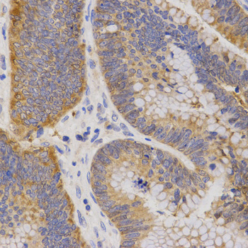 Anti-P2RY11 Antibody (CAB3061)