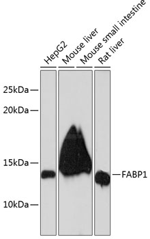 Anti-FABP1 Antibody