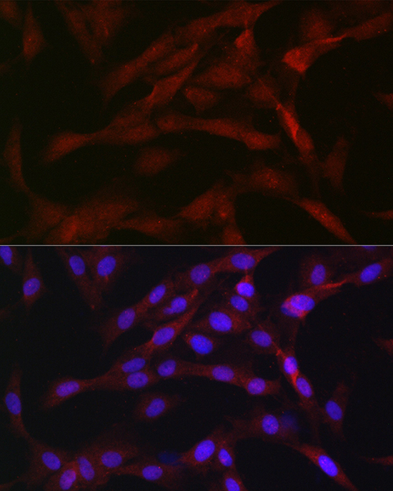 Anti-PRKCB Antibody (CAB13628)