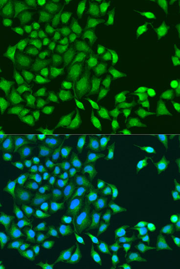 Anti-RUVBL1 Antibody (CAB14195)