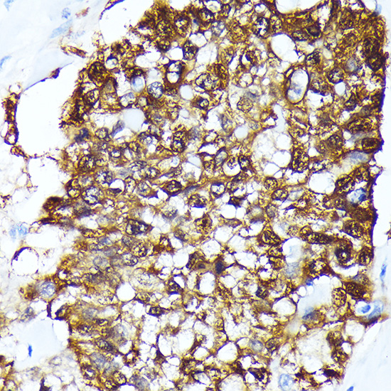 Anti-FKBP4 Antibody (CAB5643)