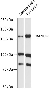 Anti-RANBP6 Antibody (CAB14477)