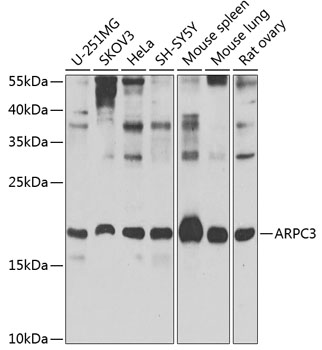Anti-ARPC3 Antibody (CAB7767)
