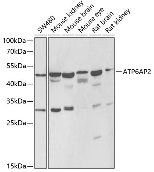 Anti-ATP6AP2 Antibody (CAB6531)