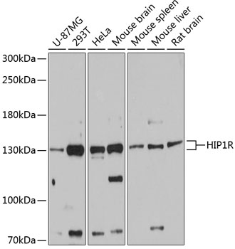 Anti-HIP1R Antibody (CAB12026)