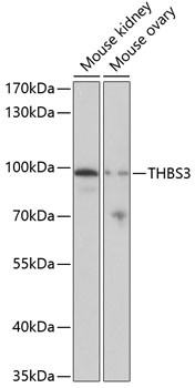 Anti-THBS3 Antibody (CAB3641)