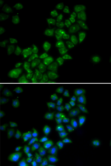 Anti-CANT1 Antibody (CAB14157)