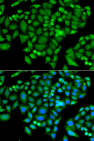 Anti-CHAF1B Antibody (CAB6259)