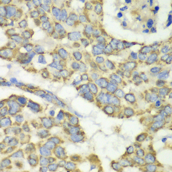 Anti-TUFM Antibody (CAB6423)