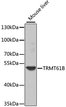 Anti-TRMT61B Polyclonal Antibody (CAB8067)