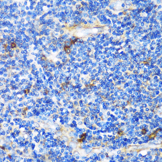 Anti-PTCH1 Antibody (CAB0826)