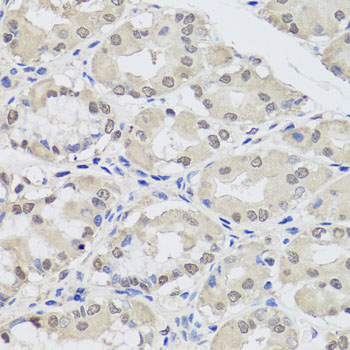 Anti-Argonaute-2 Antibody (CAB6802)