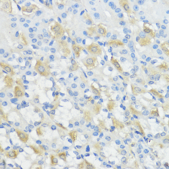 Anti-GPX2 Antibody (CAB15999)