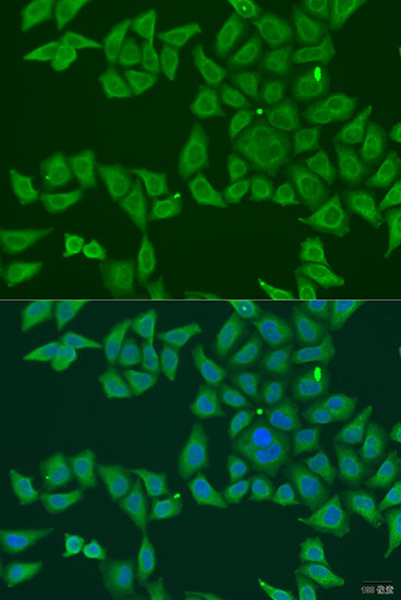 Anti-FKBP2 Polyclonal Antibody (CAB8120)