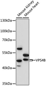 Anti-VPS4B Antibody (CAB15758)