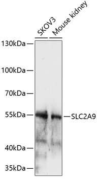 Anti-SLC2A9 Antibody (CAB14592)