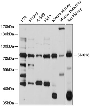 Anti-SNX18 Antibody (CAB10337)