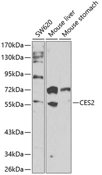 Anti-CES2 Antibody (CAB13640)