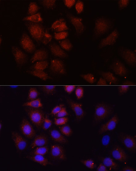 Anti-HRNR Antibody (CAB16620)