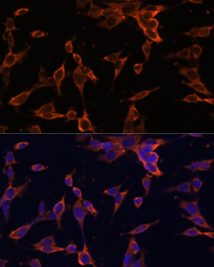 Anti-USP36 Antibody (CAB13115)