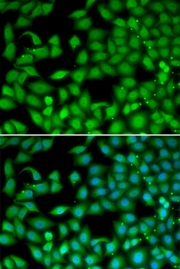 Anti-RTKN Antibody (CAB13349)