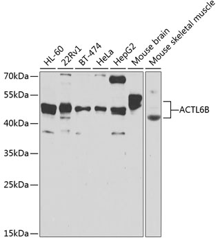 Anti-ACTL6B Antibody (CAB7108)