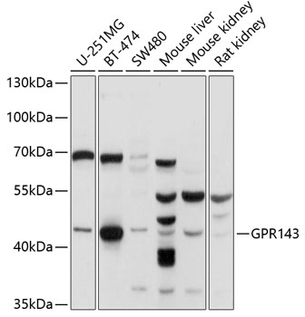 Anti-GPR143 Antibody (CAB10568)